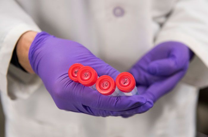 Nový krvný test dokáže zistiť viac ako 50 druhov rakoviny