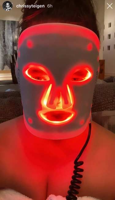 Geriausios LED veido kaukės įveikė odos stresą